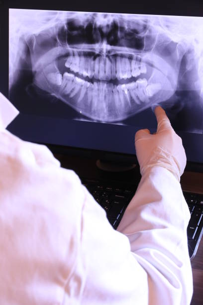 Best Emergency Wisdom Tooth Extraction in Camp Verde, AZ