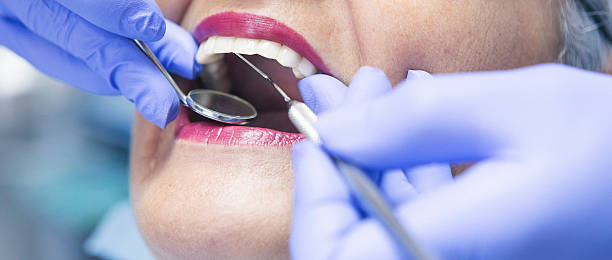 Best Knocked-Out Tooth (Avulsed Tooth) Treatment in Camp Verde, AZ